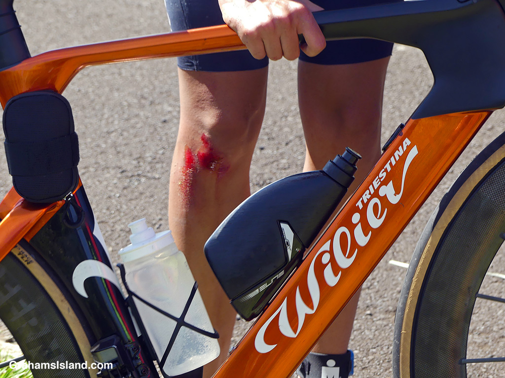 A cyclist in the 2026 Ironman 70.3 race in Hawaii, with a cut leg after he hit a pothole and crashed